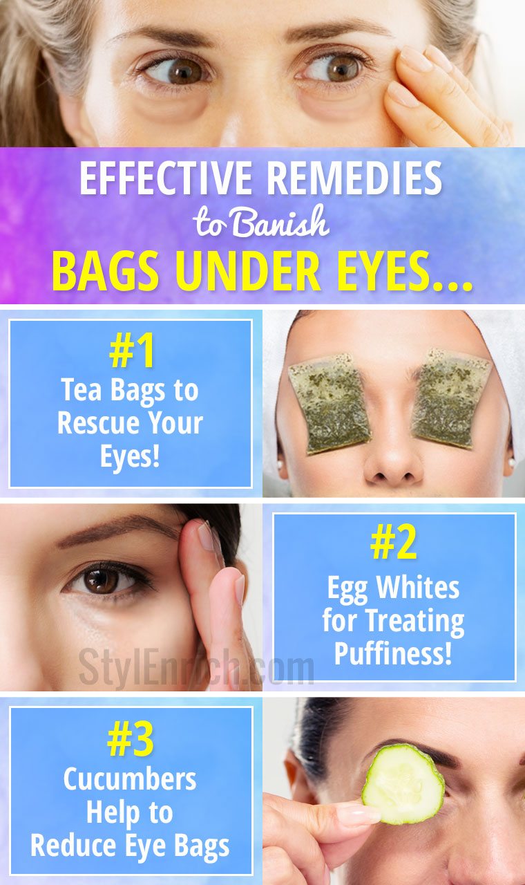 how to get rid of baggy eyes fast