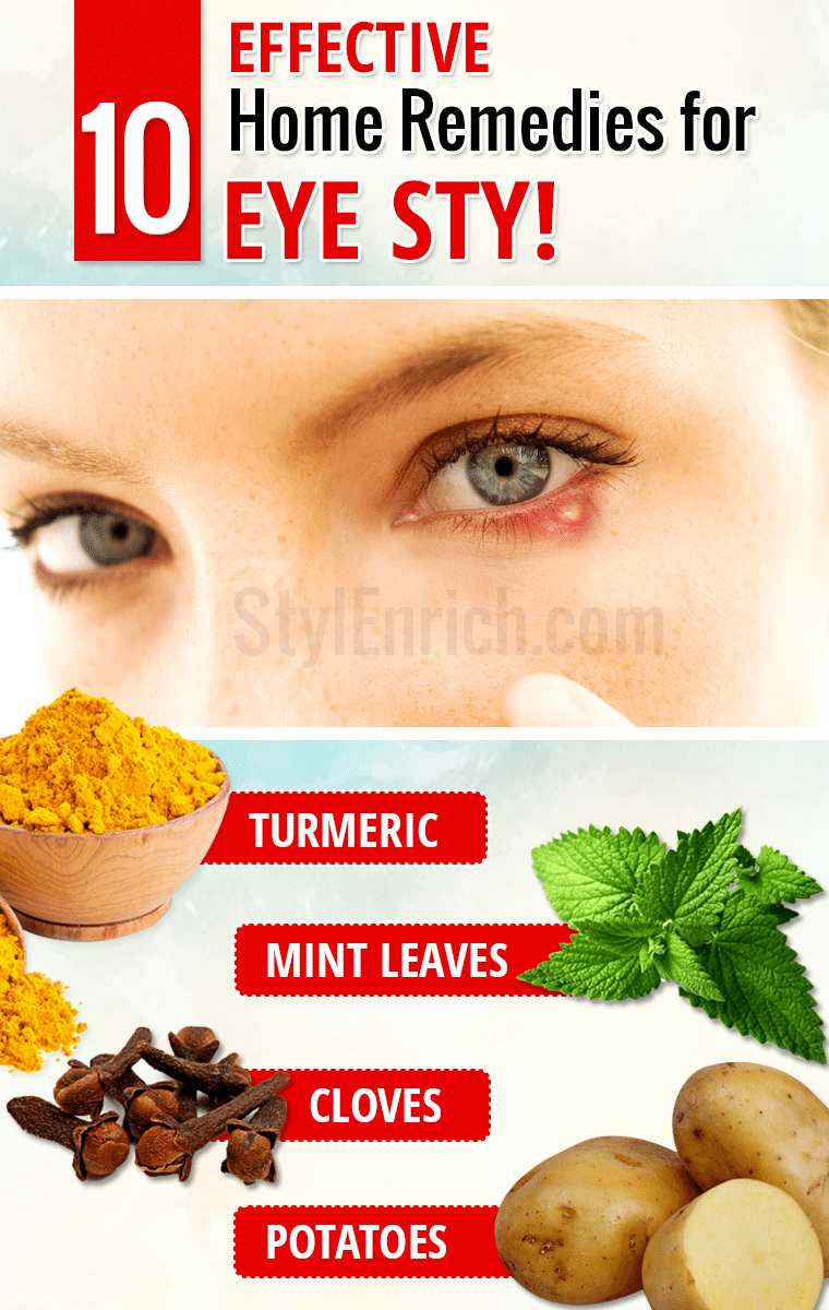 Home Remedies For Eye Stye The Effective Treatments For Eye Stye