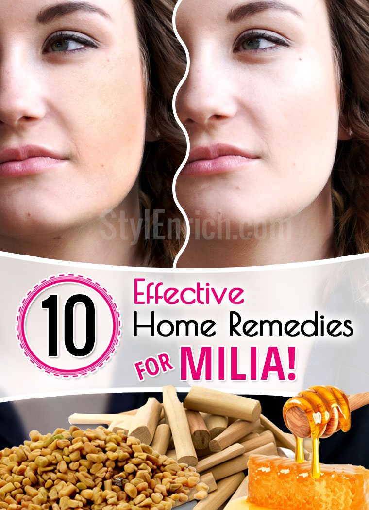 How to Get Rid of Milia - The Cosmetics Cop