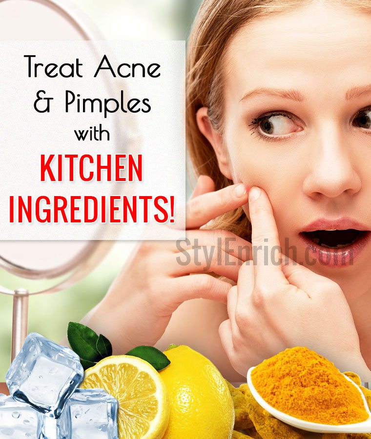 Get rid of acne with home remedies |