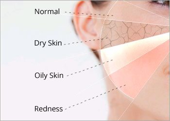 Know-your-skin-type-for-facial