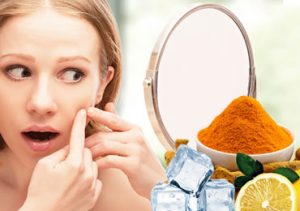 Get Rid of Acne with Home Remedies