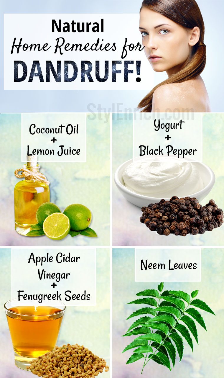 Home Remedies for Dandruff : How to Get Rid of Dandruff