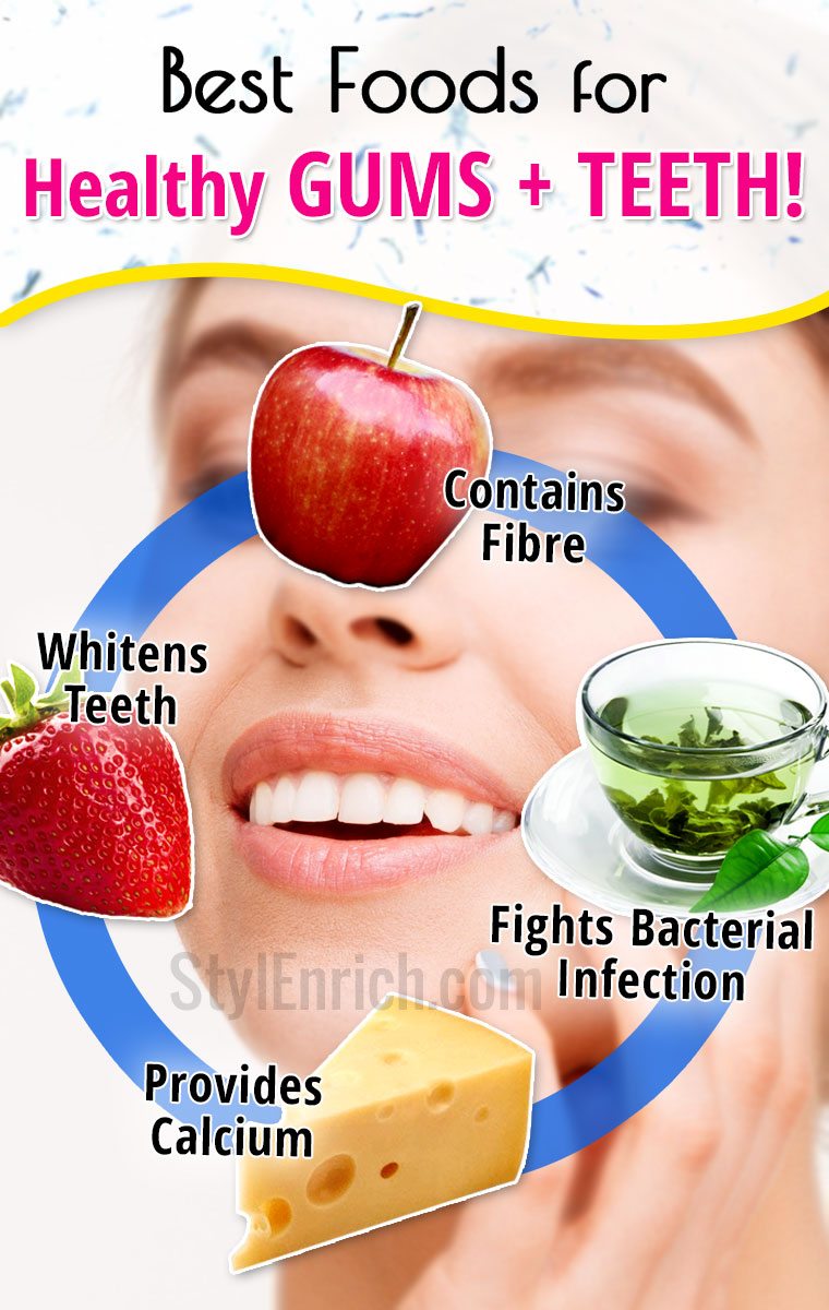 Foods for Healthy Gums and Strong Teeth That You Must Aware of!