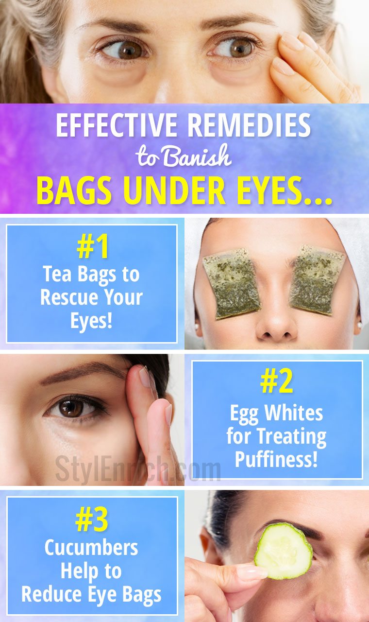 how-to-remove-eyebags-under-eye-bags-undereye-eye-bag-remedies