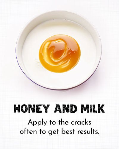 Honey and Milk for Dry Cracked Feet