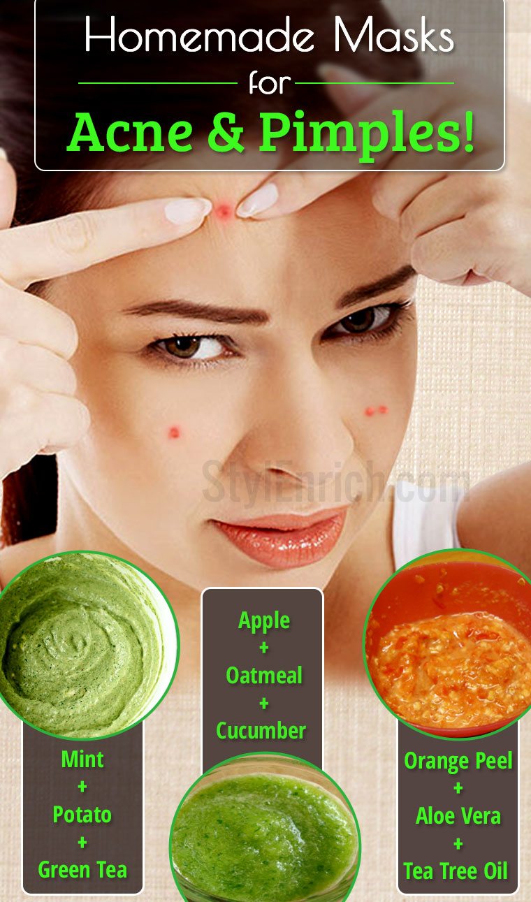 Home Remedies for Pimples : 3 Homemade Masks to Treat Acne﻿