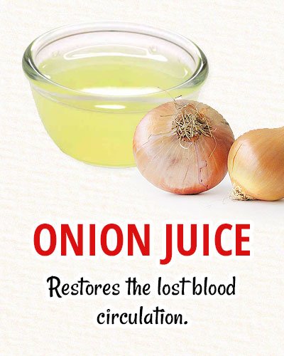 Onion Juice For Natural Hair Restoration