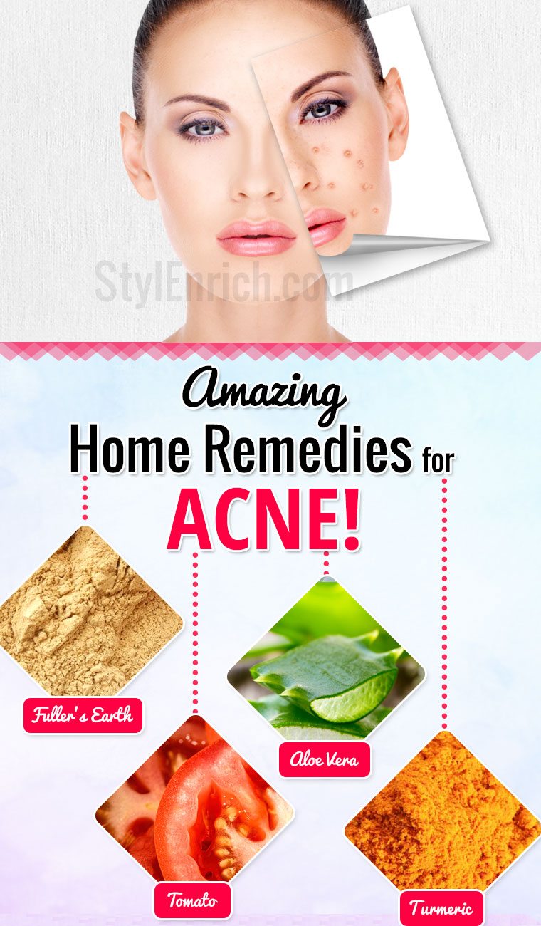 How to get rid of acne