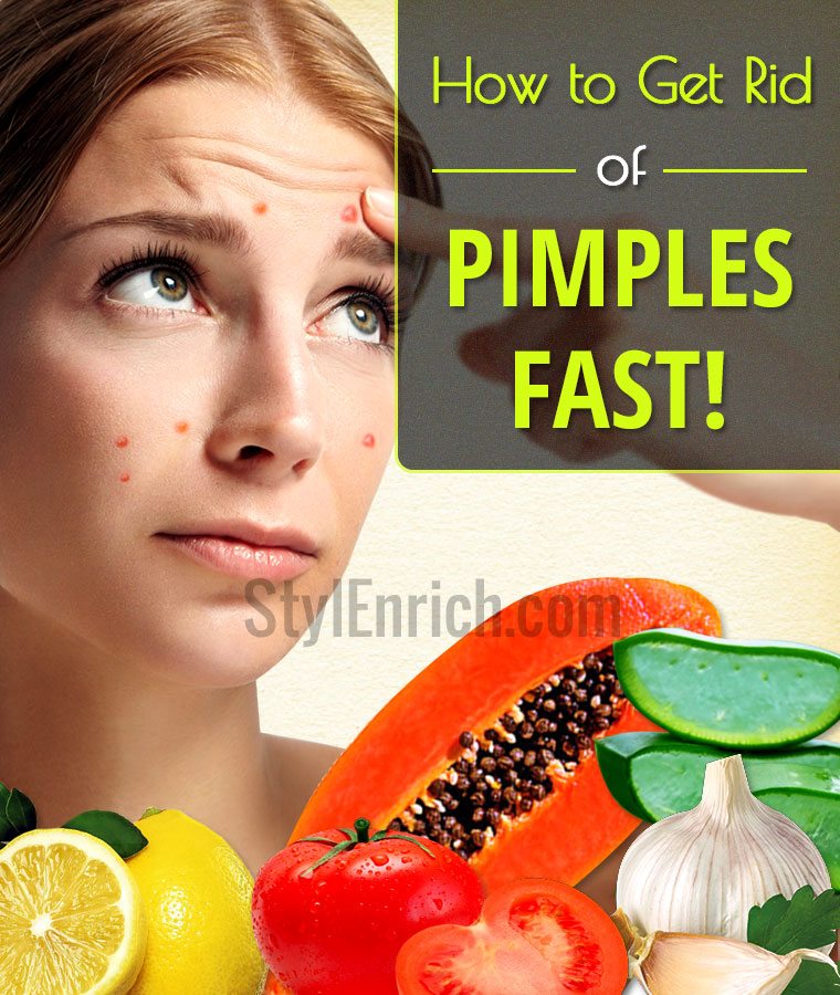 How to get rid of pimples