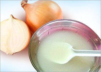 Onion-juice-home-remedies