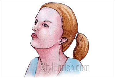 Chin lift to lose weight in face