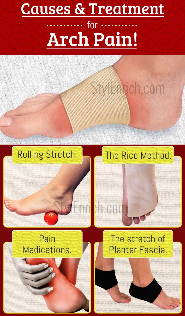 arch pain in foot relief