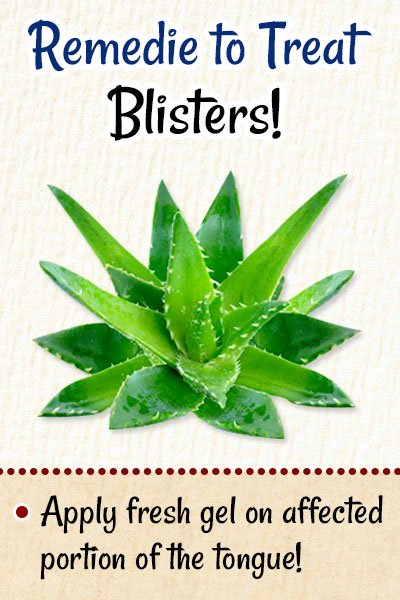 Aloe Vera To Get Rid of Blisters