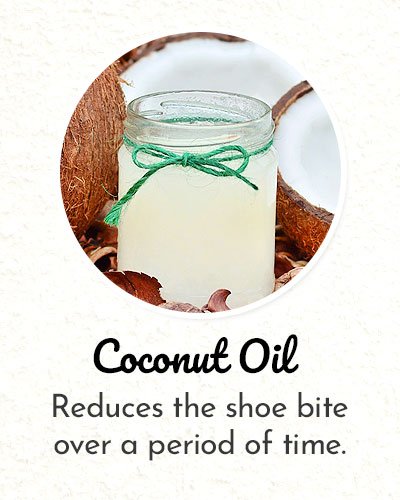 Coconut Oil for Shoe Bite