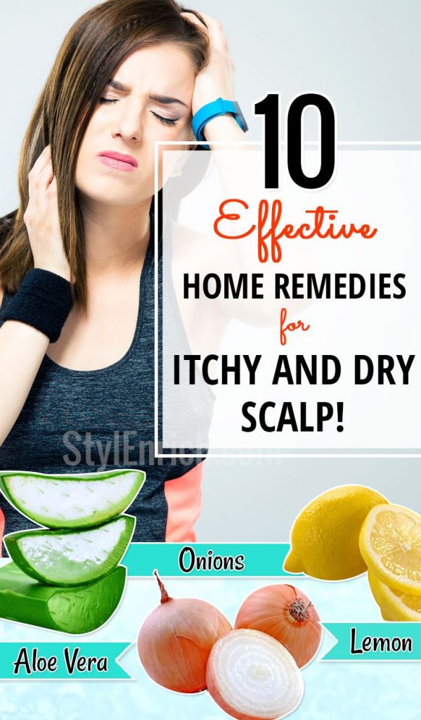 Home Remedies for Itchy Scalp : How To Get Rid of Dryness in Scalp