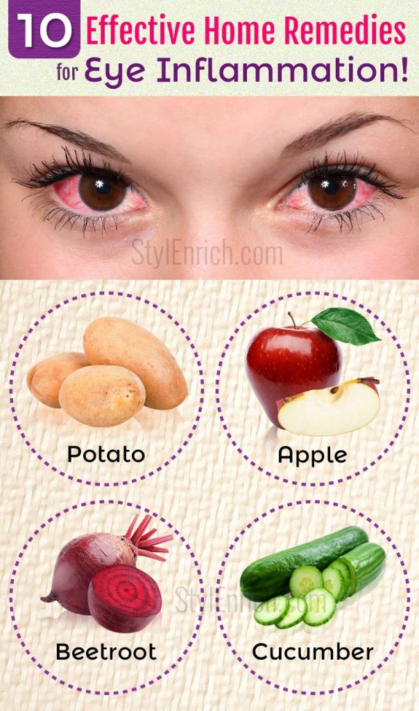 Home Remedies For Eye Inflammation - 10 Effective Ways