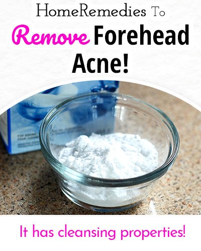 Baking Soda to Remove Forehead Acne