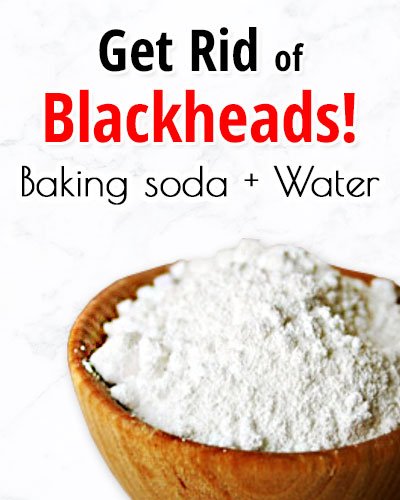 Water and Baking Soda for Blackheads On Chin