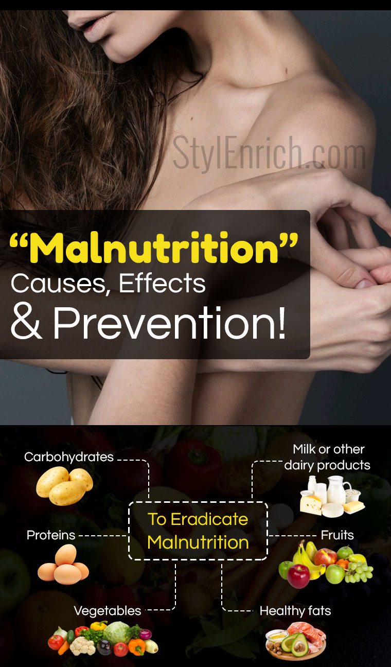 Causes of malnutrition