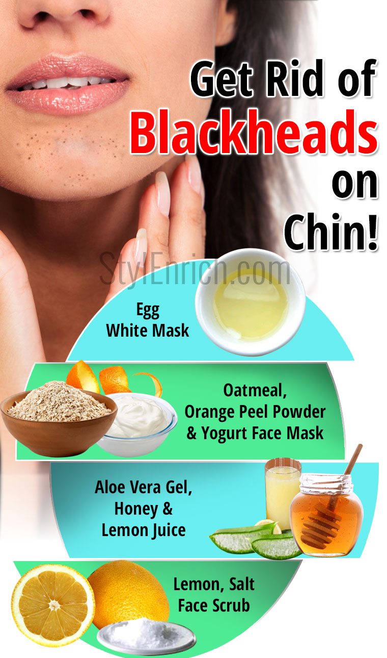 Home Remedies for Blackheads On Chin