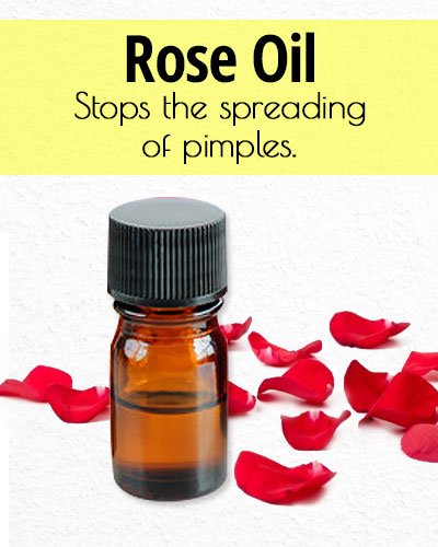 Rose Essential Oil for Acne Treatment