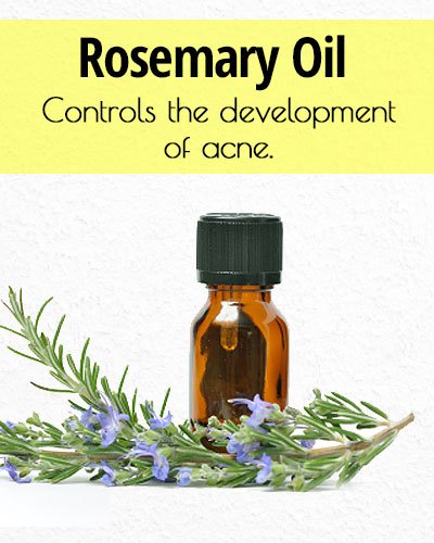 Rosemary Oil for Acne Treatment