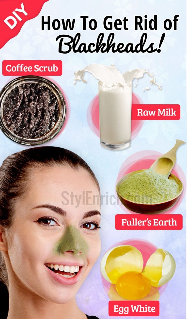 Home remedies for blackheads