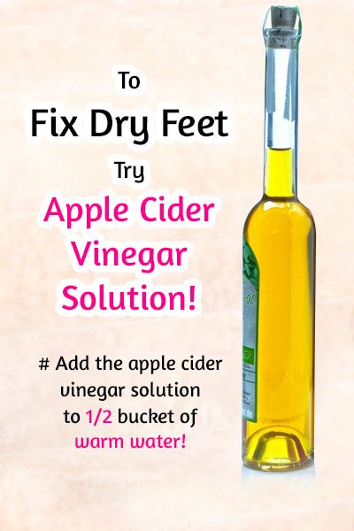 Apple Cider Vinegar Solution to Fix Dry Feet