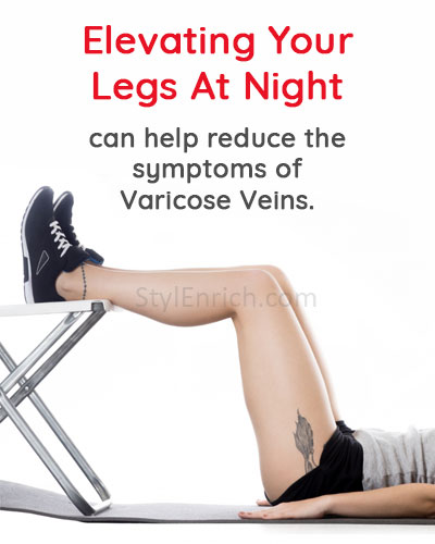 Elevating Your Legs Can Help Reduce Symptoms of Varicose Veins