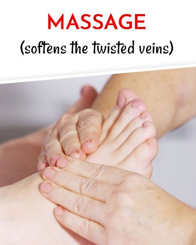 Massage to Get Rid of Varicose Veins