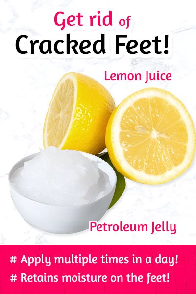 Petroleum Jelly and Lemon Juice to Fix Dry Feet