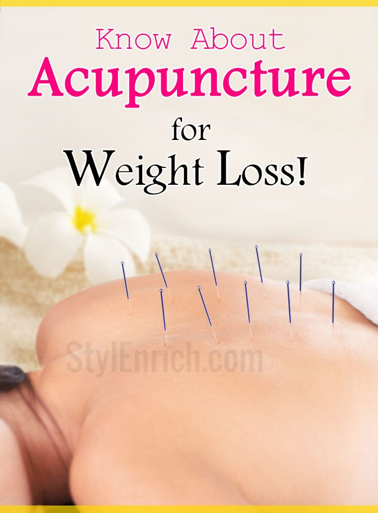 Acupuncture for weight loss