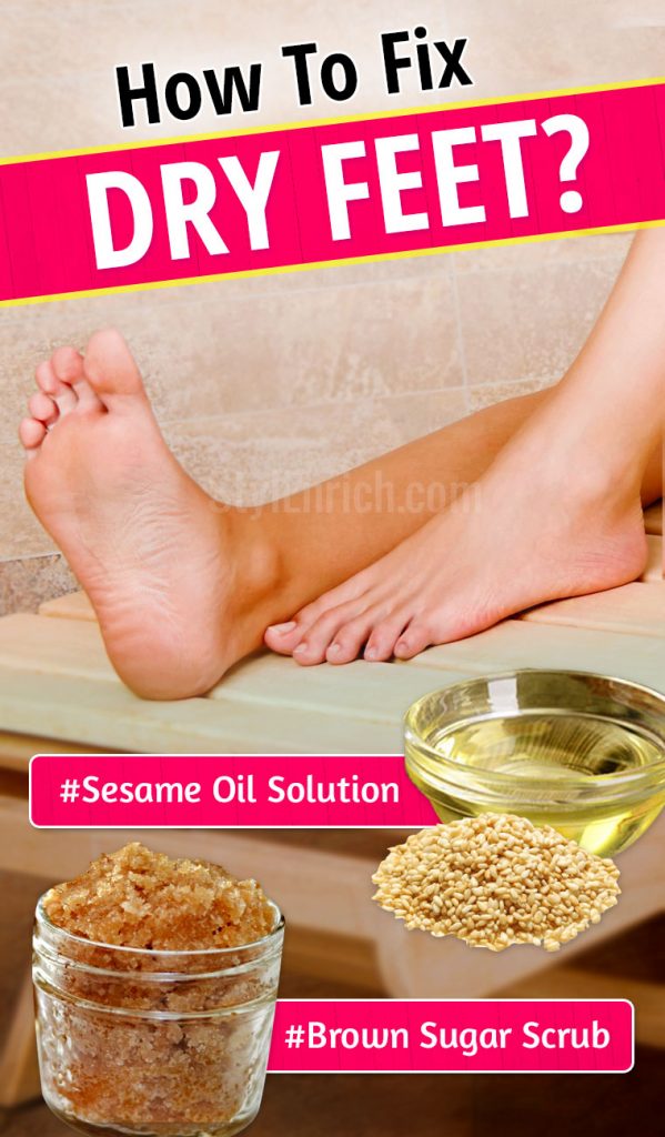 How to Fix Dry Feet HomeBased Remedies To Cure Dry Feet