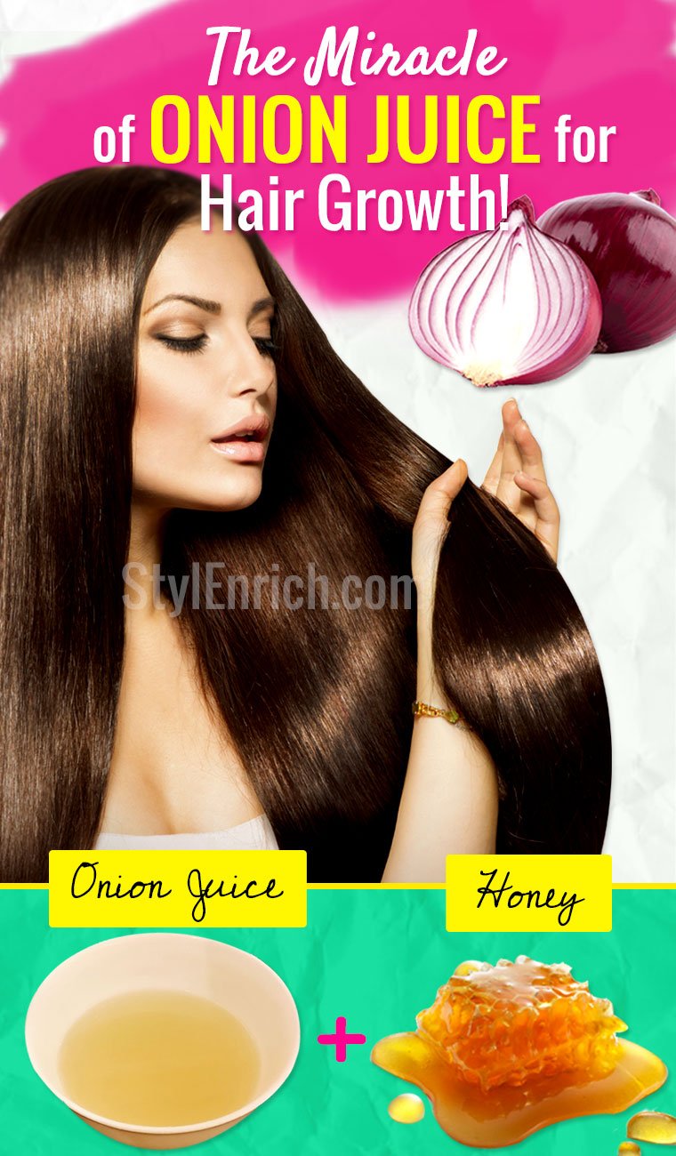 Miracle of onion juice for hair growth