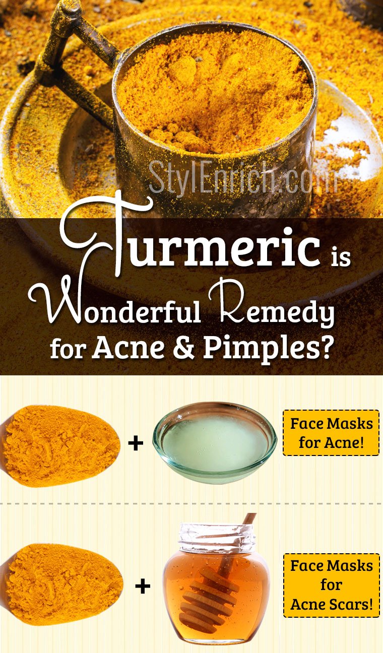 Turmeric for Acne and Pimples