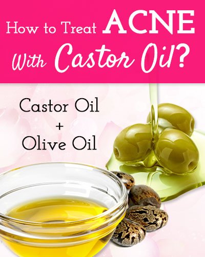 Castor oil and Olive Oil For Acne