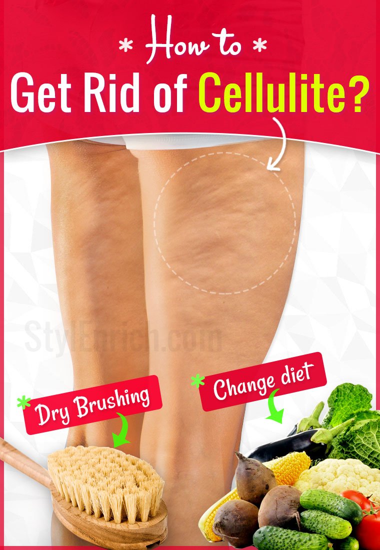 How to Get Rid of Cellulite?