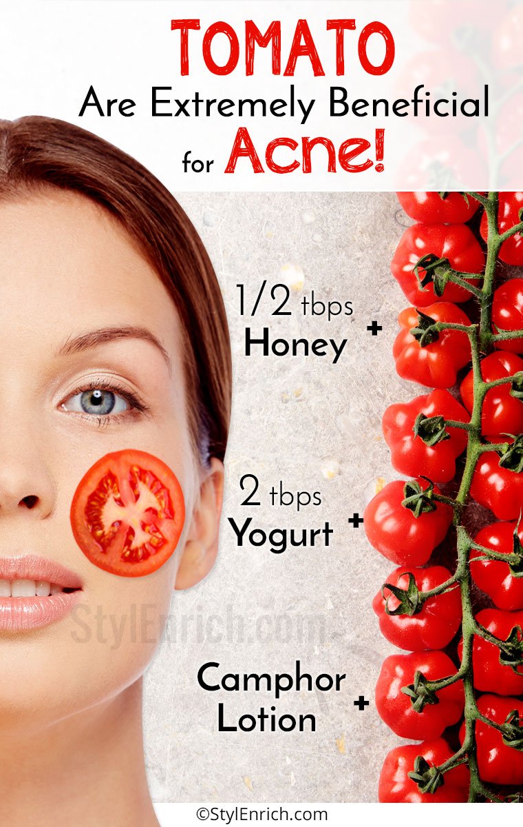 Tomato for Acne