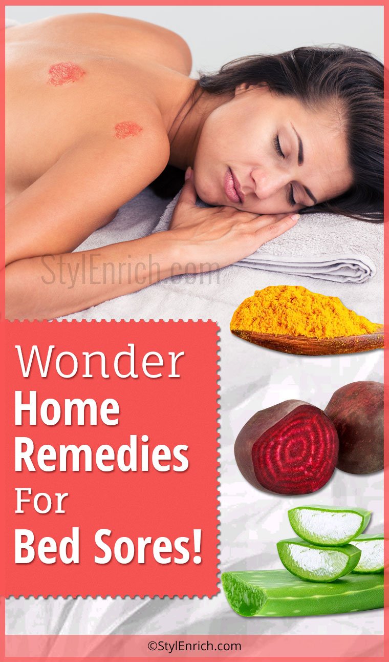 home-remedies-for-bed-sores-wonder-treatments