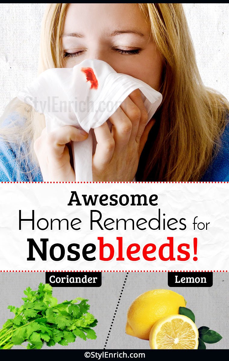 Stop nose bleeds Using awesome home remedies

