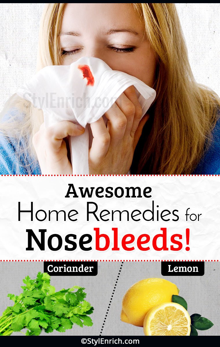 Stop nose bleeds Using awesome home remedies

