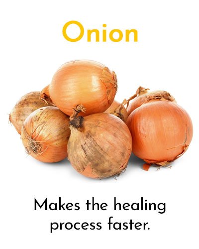 Onion for Minor Cuts and Grazes