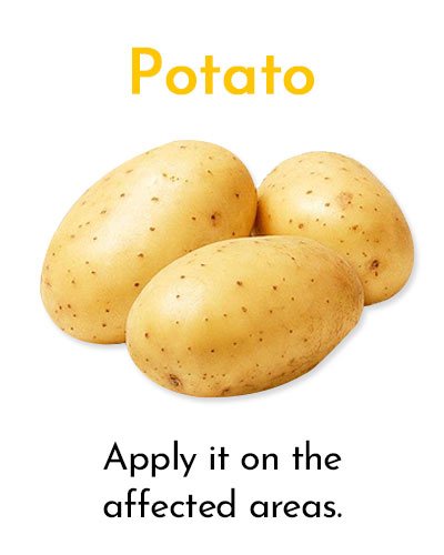 Potato for Minor Cuts and Grazes