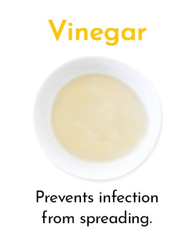 Vinegar for Minor Cuts and Grazes