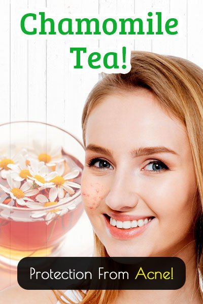 Chamomile Tea for Acne