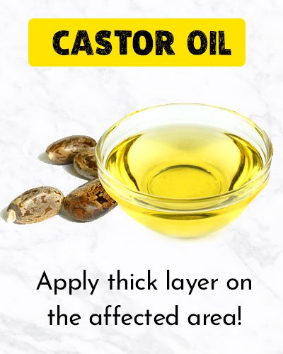 Castor Oil For Ingrown Hair