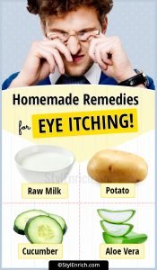 Home Remedies For Eye Itching - Try Some Effective Methods!