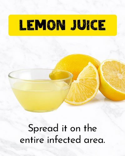Lemon Juice To Get Rid Of Ingrown Hair