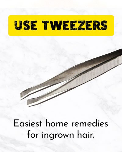 Use Tweezers To Get Rid Of Ingrown Hair